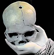 Skull in Tuol Sleng by Asienreisender